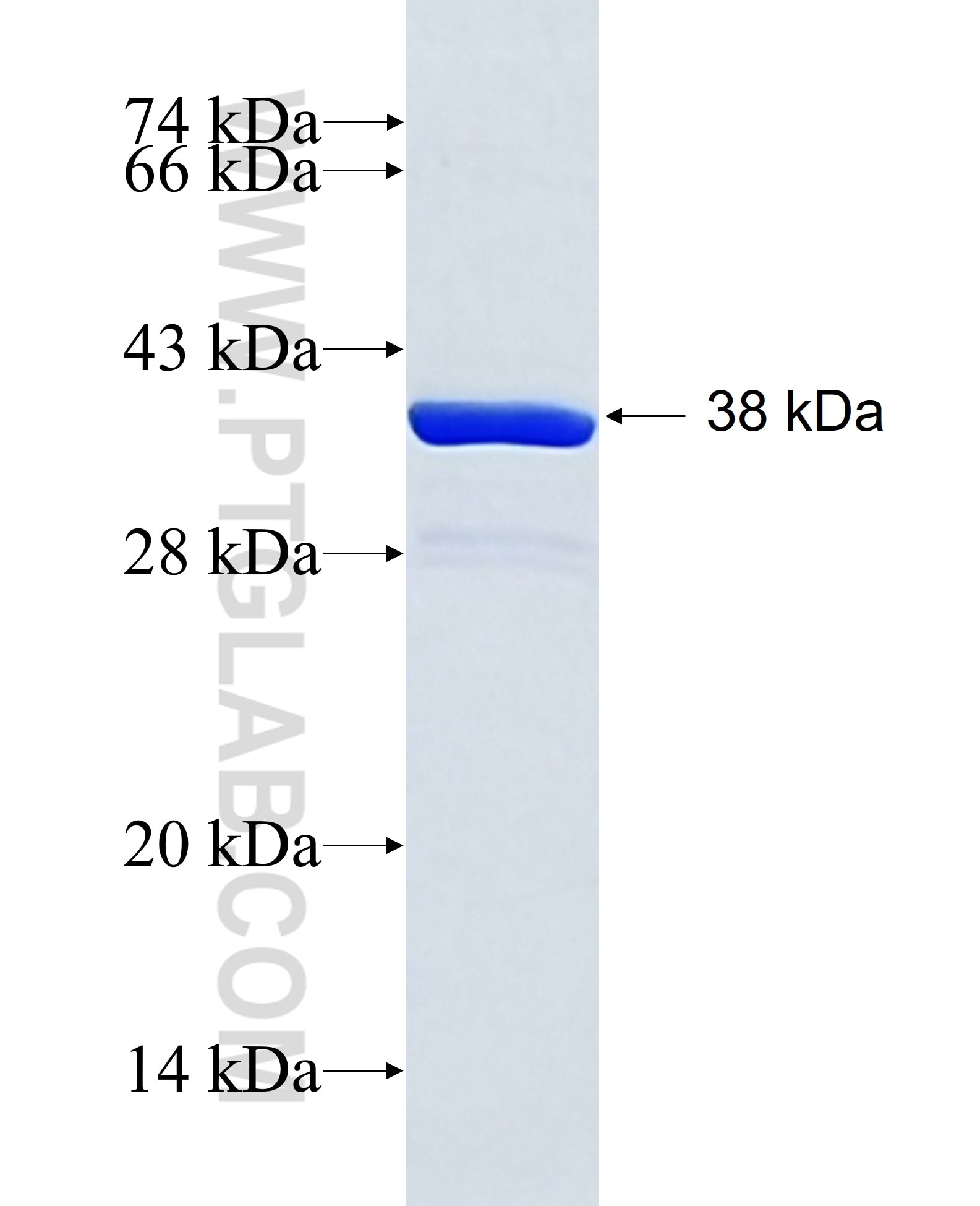 ALOX15 fusion protein Ag27215 SDS-PAGE