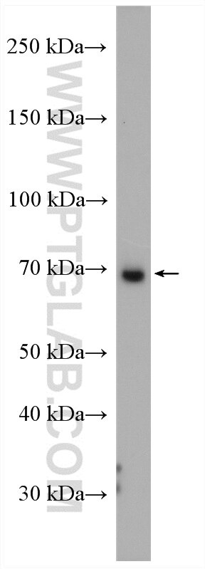 Western Blot (WB) analysis of HEK-293 cells using 15 Lipoxygenase 2 Polyclonal antibody (13073-1-AP)