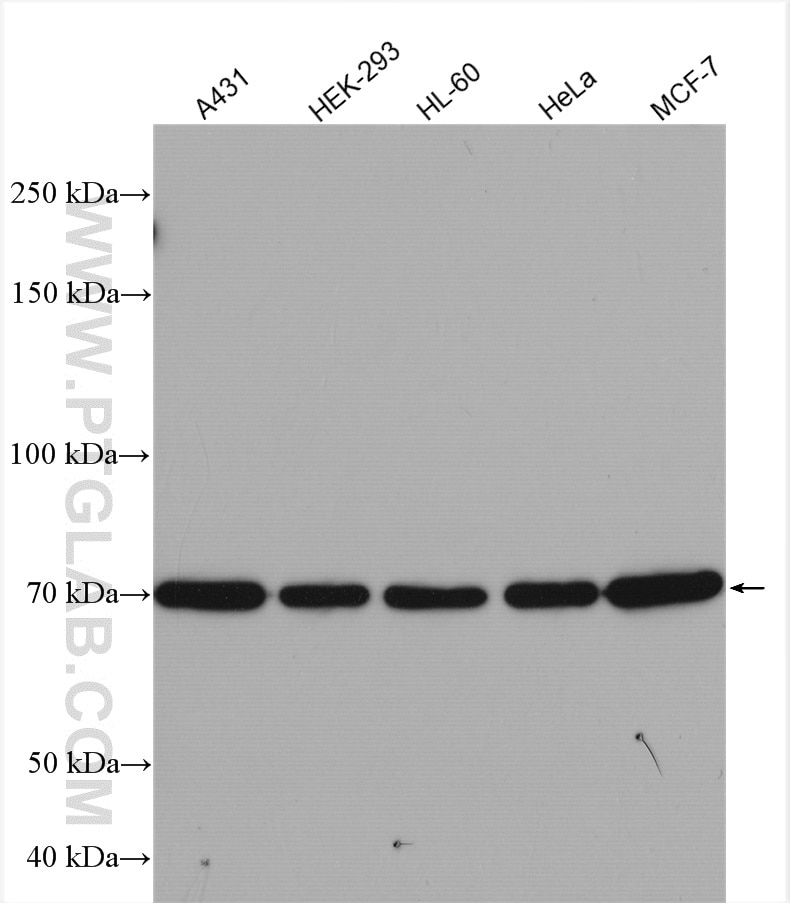 Western Blot (WB) analysis of A431 cells using 15 Lipoxygenase 2 Polyclonal antibody (13073-1-AP)