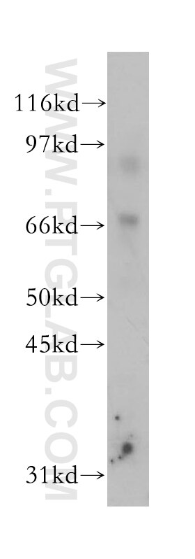 15 Lipoxygenase 2