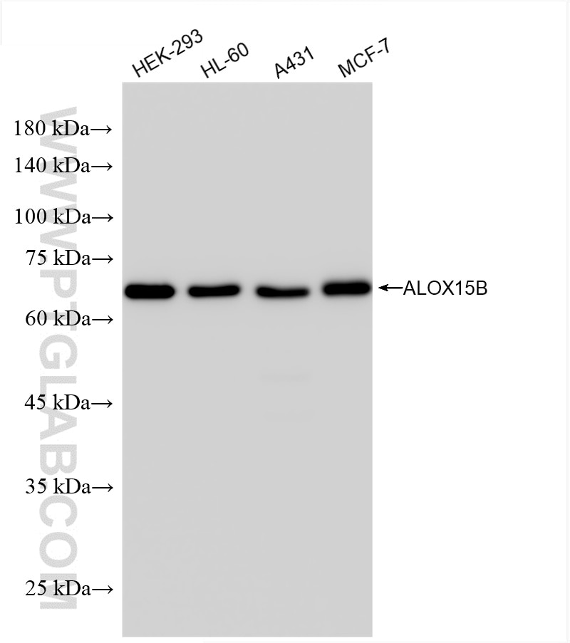 ALOX15B