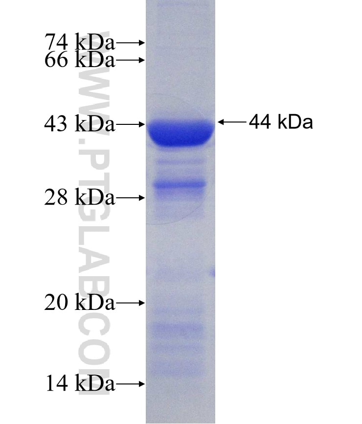ALOX15B fusion protein Ag30796 SDS-PAGE