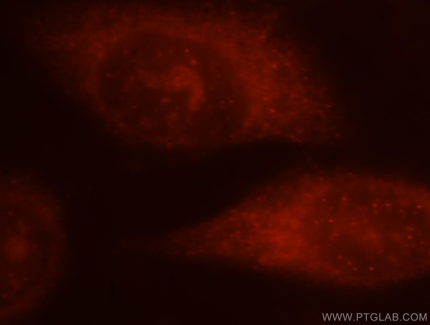 Immunofluorescence (IF) / fluorescent staining of HeLa cells using 5 Lipoxygenase Polyclonal antibody (10021-1-Ig)