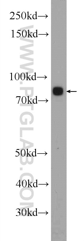 Western Blot (WB) analysis of HL-60 cells using 5 Lipoxygenase Polyclonal antibody (10021-1-Ig)