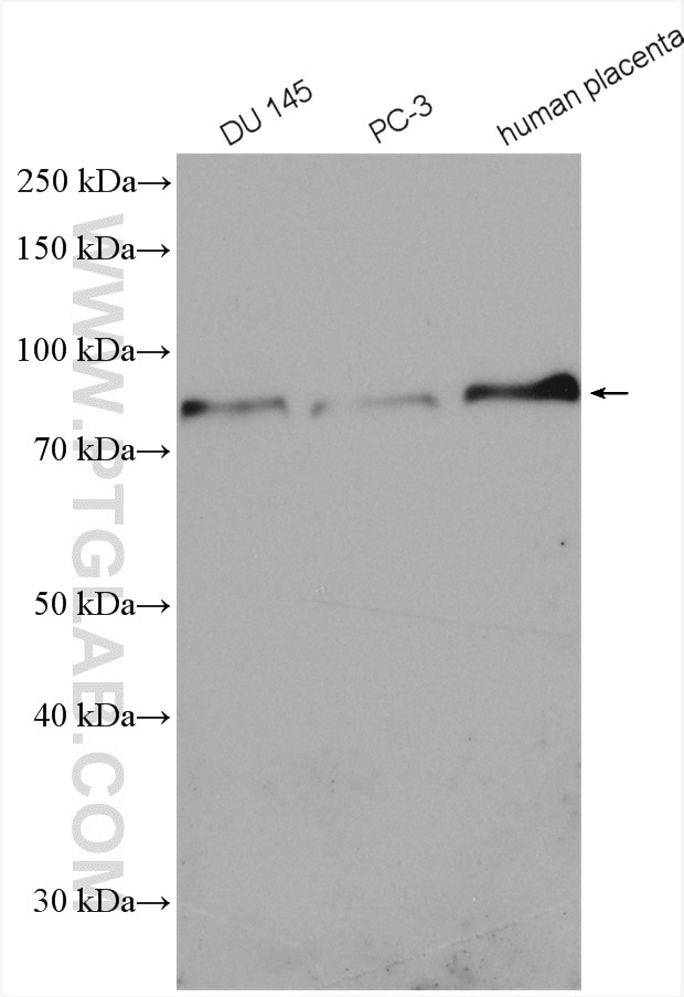 Western Blot (WB) analysis of various lysates using 5 Lipoxygenase Polyclonal antibody (10021-1-Ig)