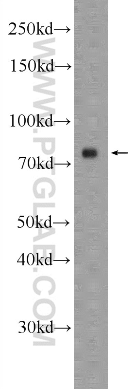 Western Blot (WB) analysis of DU 145 cells using 5 Lipoxygenase Polyclonal antibody (10021-1-Ig)