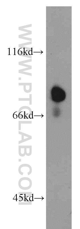 5 Lipoxygenase