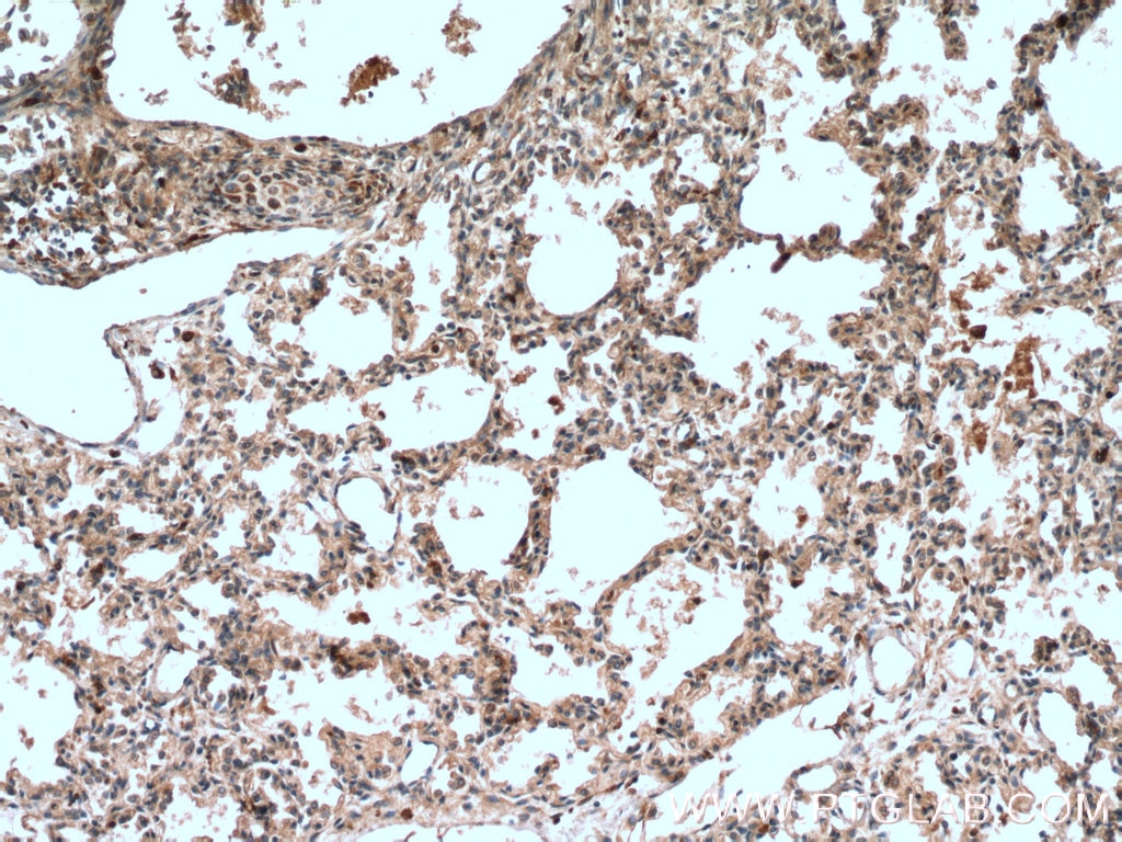 Immunohistochemistry (IHC) staining of human lung tissue using 5 Lipoxygenase Monoclonal antibody (66326-1-Ig)