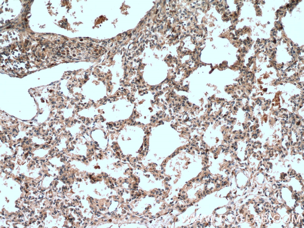 Immunohistochemistry (IHC) staining of human lung tissue using 5 Lipoxygenase Monoclonal antibody (66326-1-Ig)