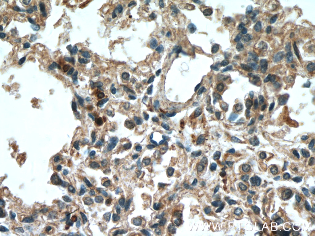 Immunohistochemistry (IHC) staining of human lung tissue using 5 Lipoxygenase Monoclonal antibody (66326-1-Ig)