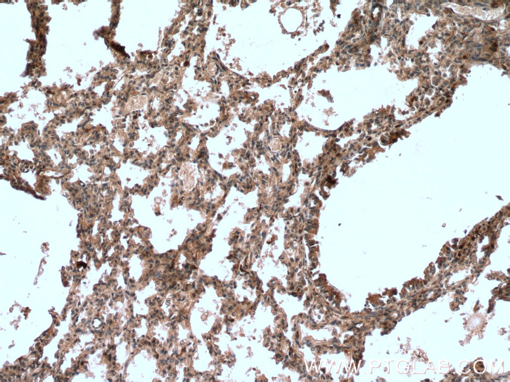 IHC staining of human lung using 66326-1-Ig