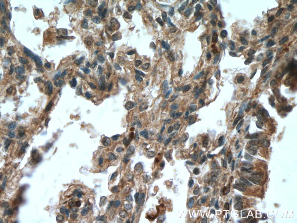 Immunohistochemistry (IHC) staining of human lung tissue using 5 Lipoxygenase Monoclonal antibody (66326-1-Ig)