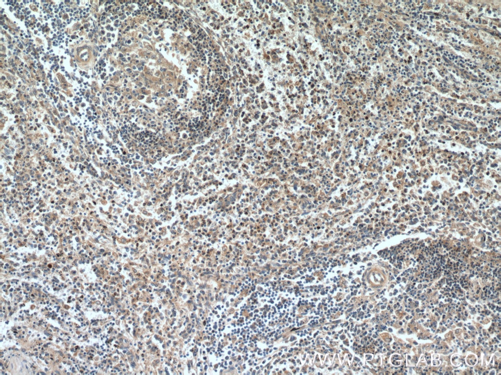 IHC staining of human spleen using 66326-1-Ig