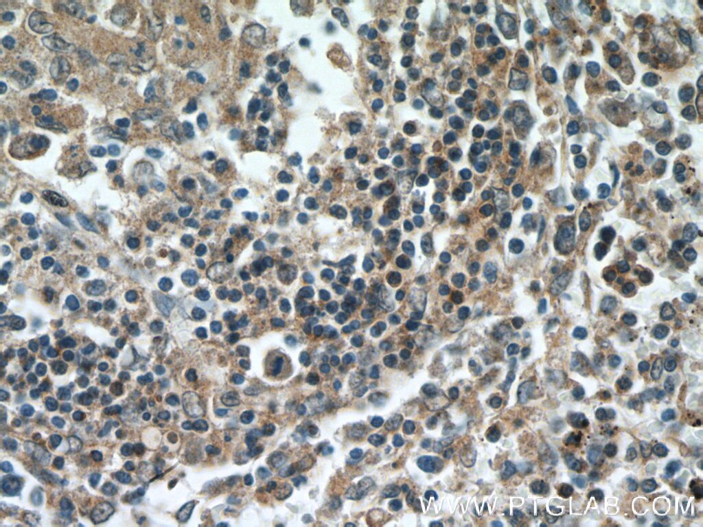Immunohistochemistry (IHC) staining of human spleen tissue using 5 Lipoxygenase Monoclonal antibody (66326-1-Ig)