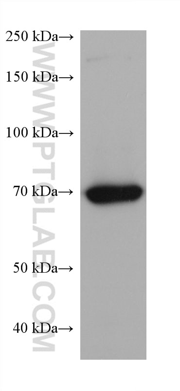 Western Blot (WB) analysis of THP-1 cells using 5 Lipoxygenase Monoclonal antibody (66326-1-Ig)