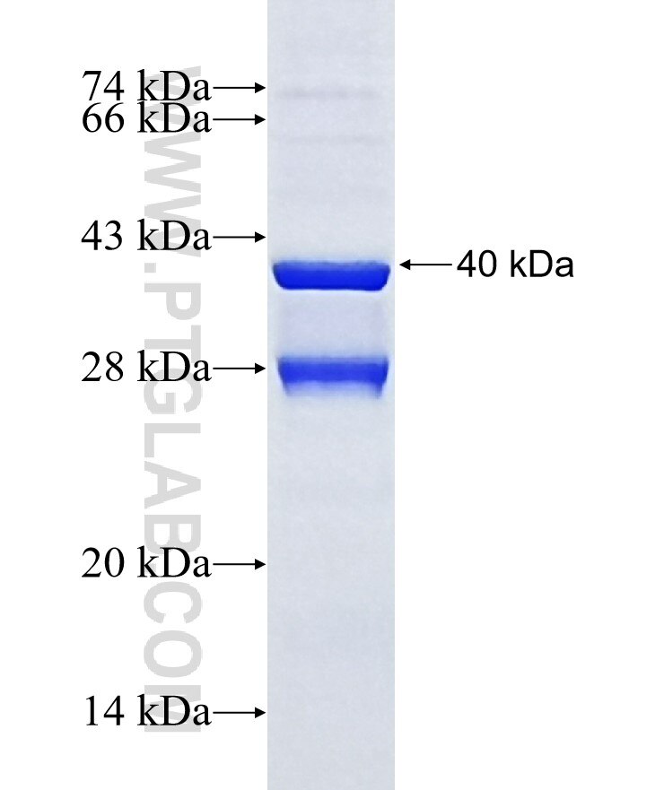 ALOX5AP fusion protein Ag3144 SDS-PAGE