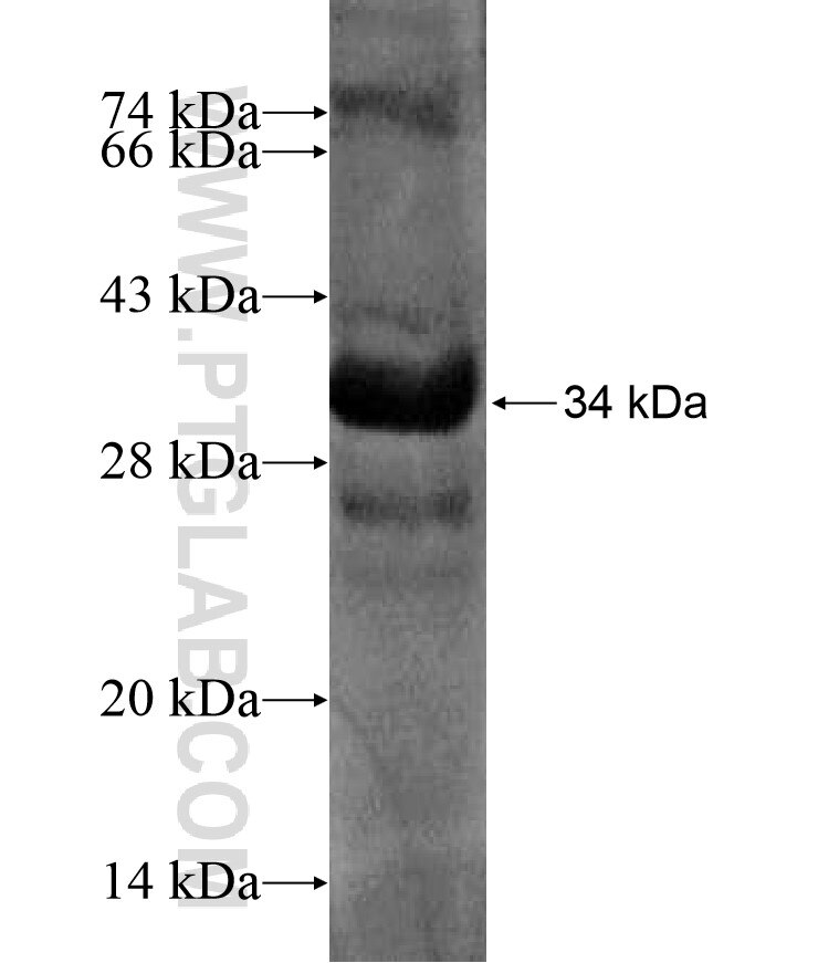 ALOXE3 fusion protein Ag17223 SDS-PAGE ALOXE3 fusion protein Ag17223 SDS-PAGE