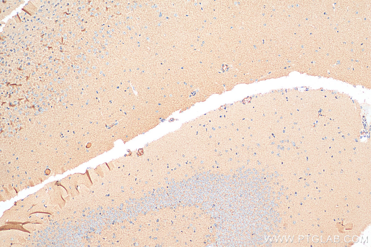 Immunohistochemistry (IHC) staining of mouse brain tissue using ALPK1 Polyclonal antibody (19107-1-AP)