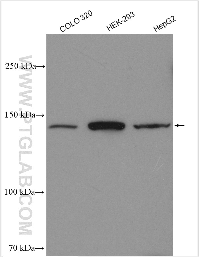 Western Blot (WB) analysis of various lysates using ALPK1 Polyclonal antibody (19107-1-AP)