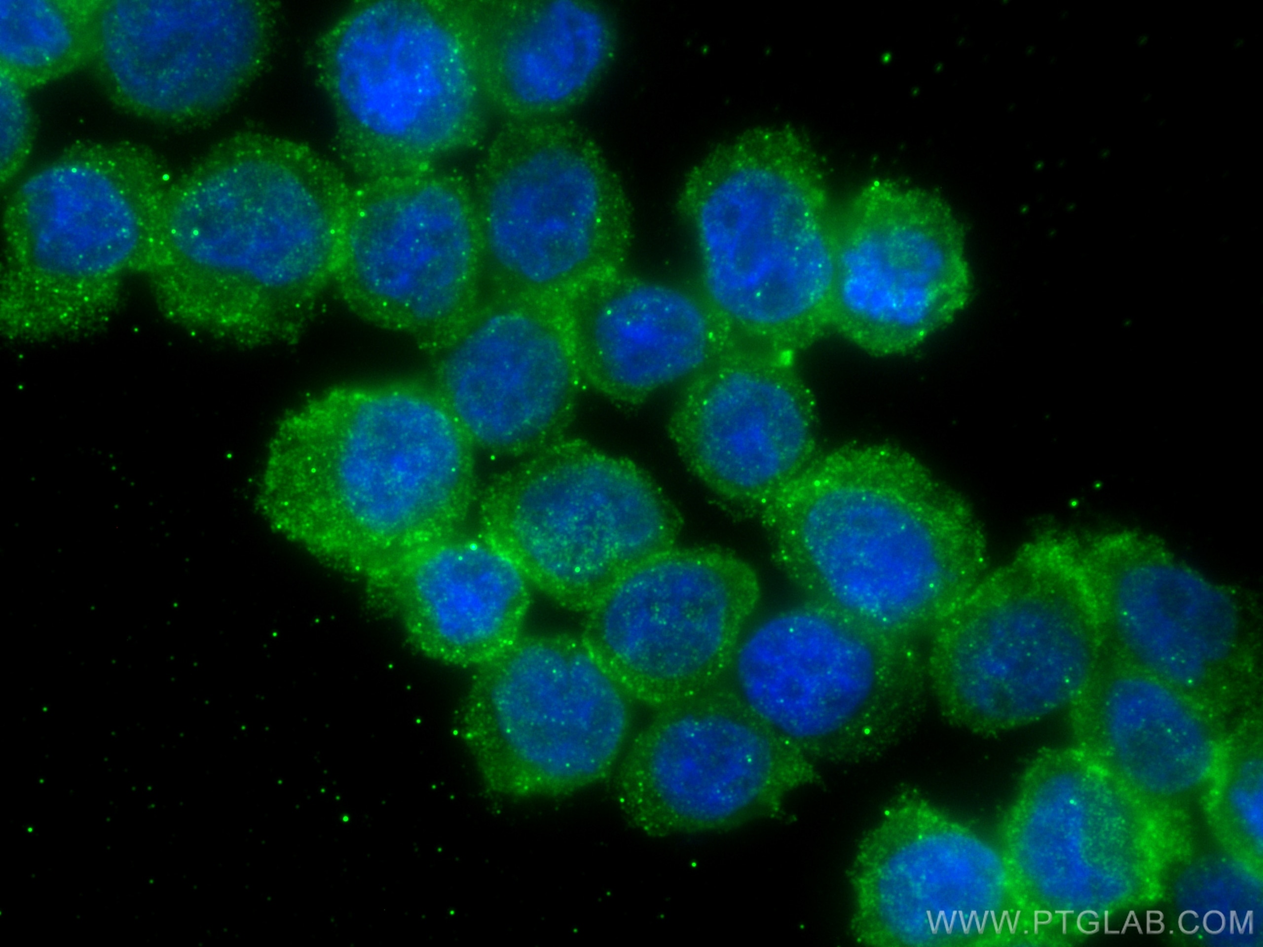 Immunofluorescence (IF) / fluorescent staining of THP-1 cells using ALPK1 Monoclonal antibody (67689-1-Ig)