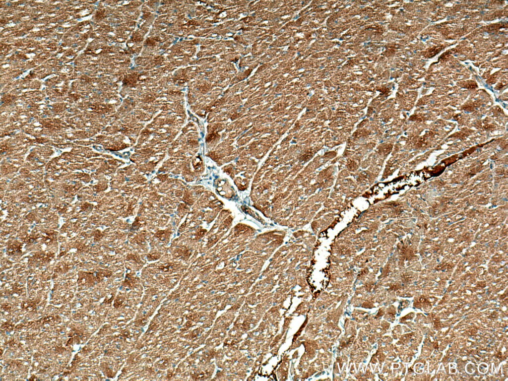 Immunohistochemistry (IHC) staining of human heart tissue using ALPK1 Monoclonal antibody (67689-1-Ig)