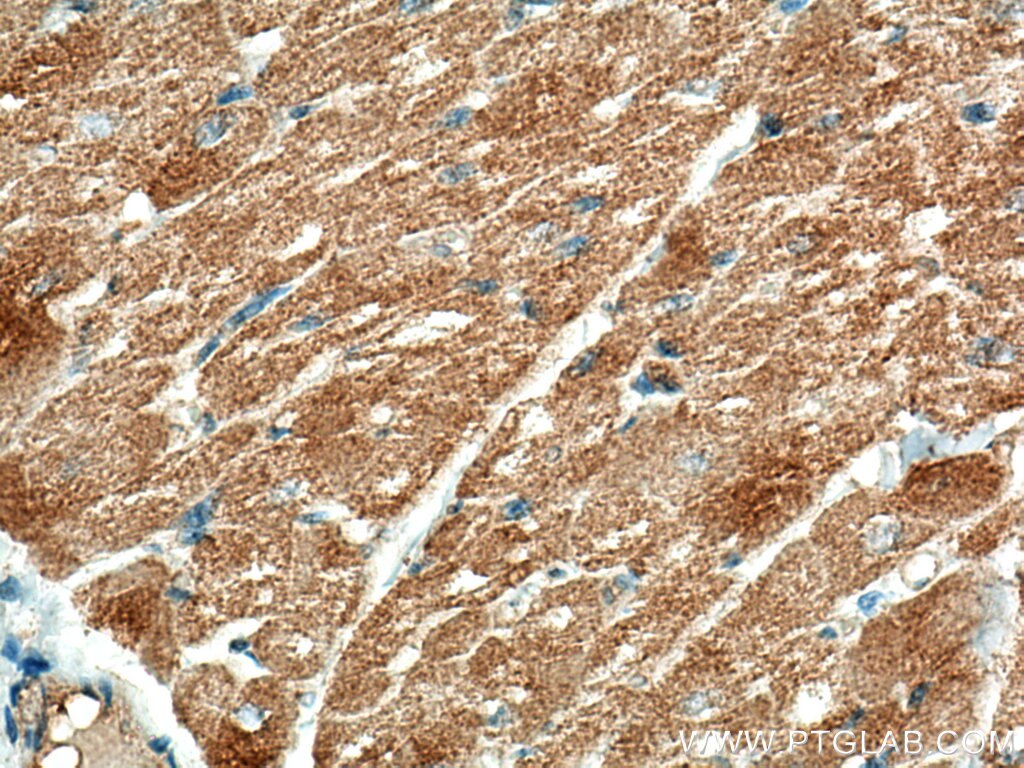 Immunohistochemistry (IHC) staining of human heart tissue using ALPK1 Monoclonal antibody (67689-1-Ig)