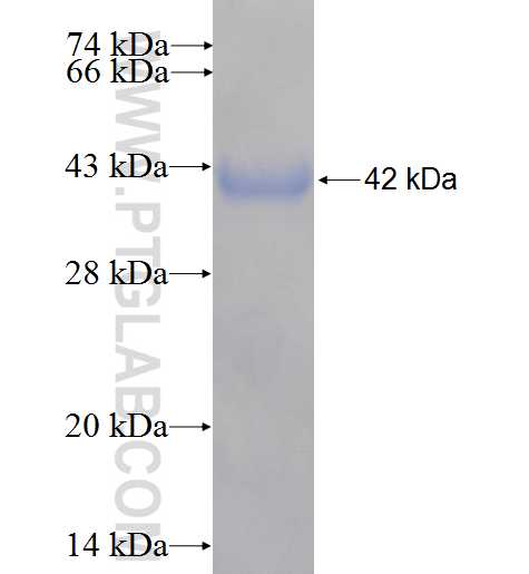 ALPK1 fusion protein Ag5320 SDS-PAGE