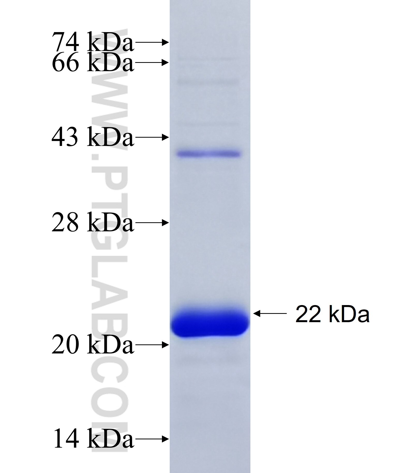 ALPK3 fusion protein Ag34720 SDS-PAGE