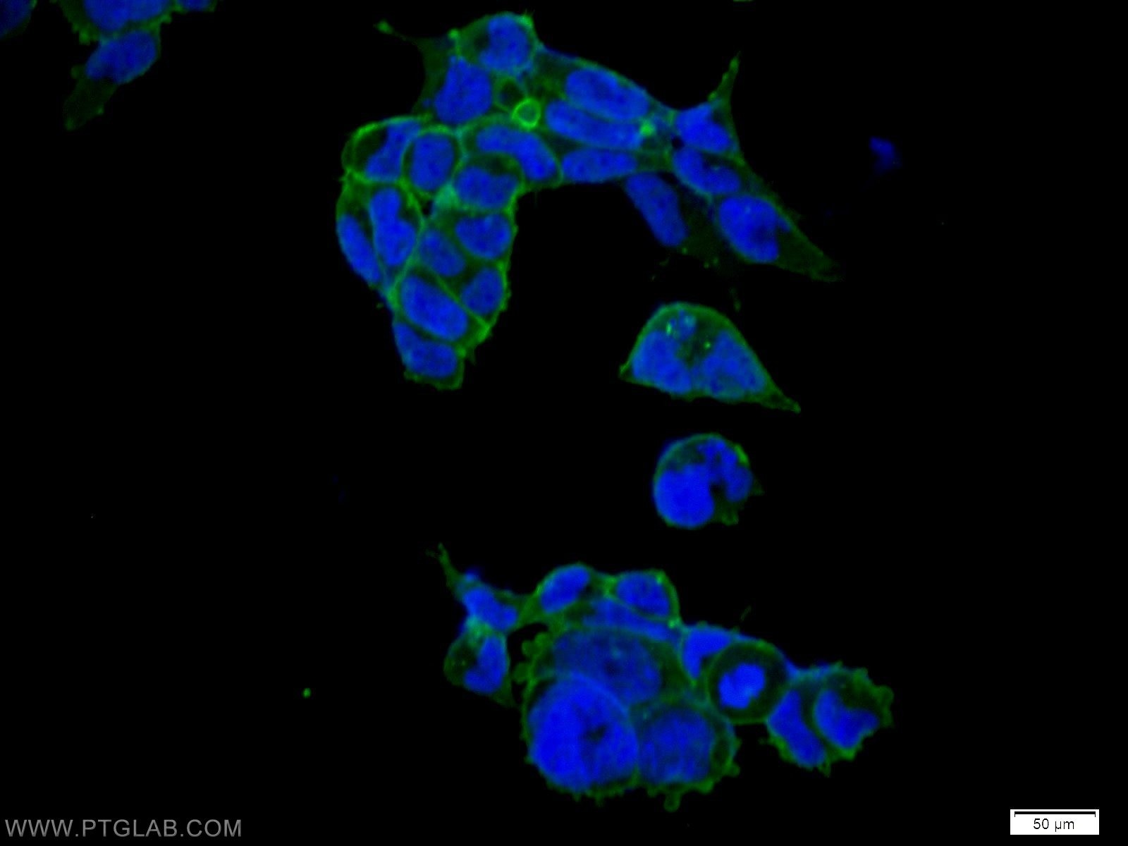Immunofluorescence (IF) / fluorescent staining of HEK-293 cells using ALPL Polyclonal antibody (11187-1-AP)