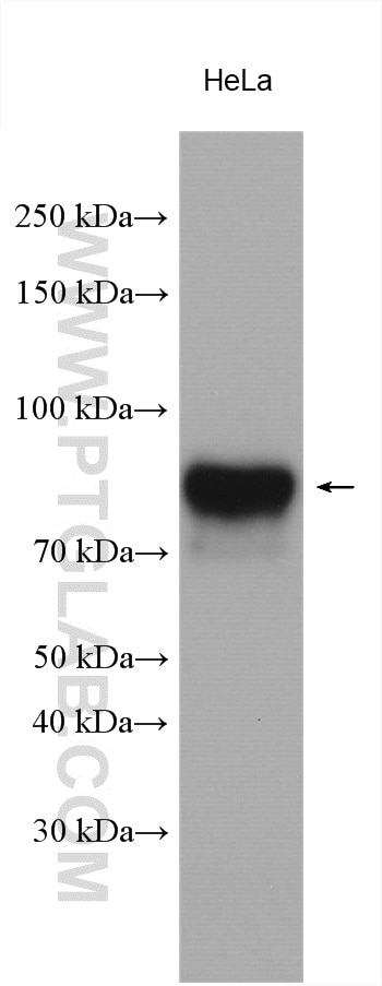 Western Blot (WB) analysis of various lysates using ALPL Polyclonal antibody (11187-1-AP)