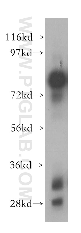 ALPL Polyclonal antibody