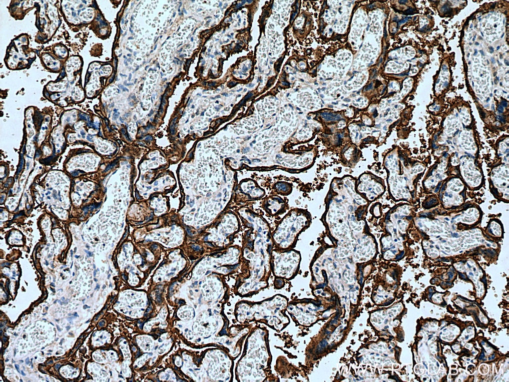 Immunohistochemistry (IHC) staining of human placenta tissue using PLAP Polyclonal antibody (18507-1-AP)