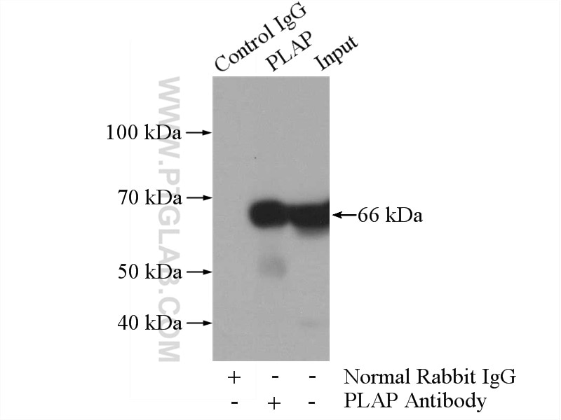 Immunoprecipitation (IP) experiment of HepG2 cells using PLAP Polyclonal antibody (18507-1-AP)