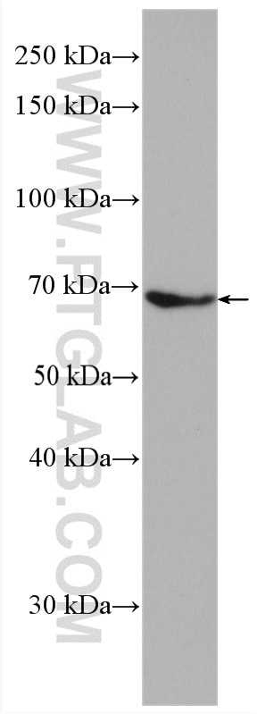 Western Blot (WB) analysis of human placenta tissue using PLAP Polyclonal antibody (18507-1-AP)