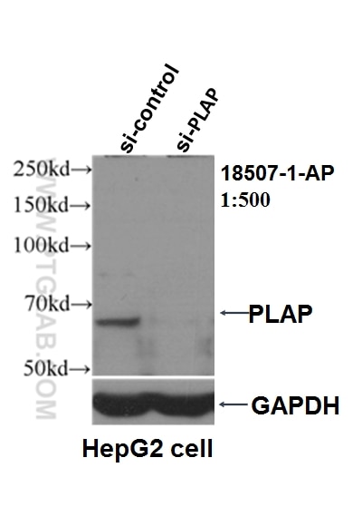 Western Blot (WB) analysis of HepG2 cells using PLAP Polyclonal antibody (18507-1-AP)