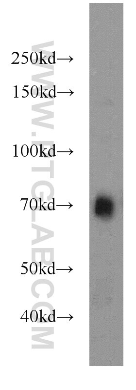 Western Blot (WB) analysis of mouse liver tissue using PLAP Polyclonal antibody (18507-1-AP)