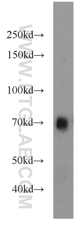 WB analysis of mouse liver using 18507-1-AP