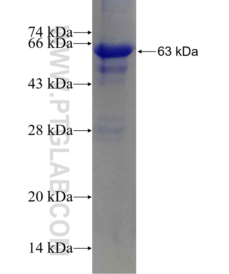 ALPP fusion protein Ag13361 SDS-PAGE