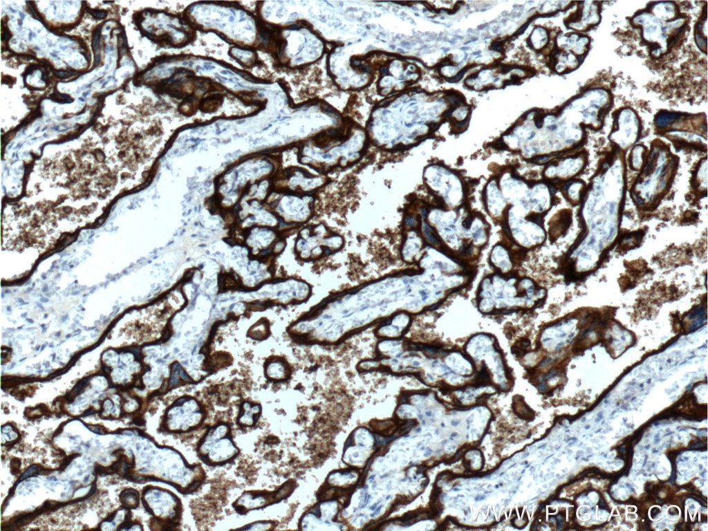 Immunohistochemistry (IHC) staining of human placenta tissue using ALPPL2 Polyclonal antibody (18506-1-AP)