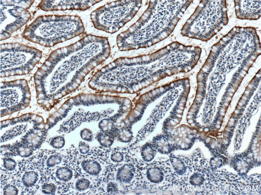 IHC staining of human small intestine using 18506-1-AP