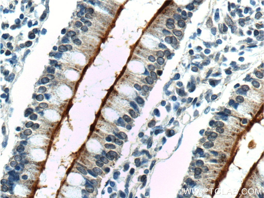 Immunohistochemistry (IHC) staining of human small intestine tissue using ALPPL2 Polyclonal antibody (18506-1-AP)