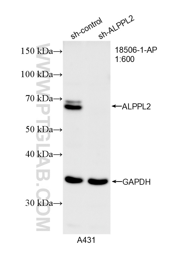 Western Blot (WB) analysis of A431 cells using ALPPL2 Polyclonal antibody (18506-1-AP)