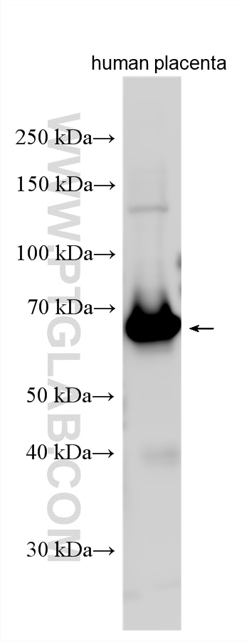 Western Blot (WB) analysis of various lysates using ALPPL2 Polyclonal antibody (18506-1-AP)