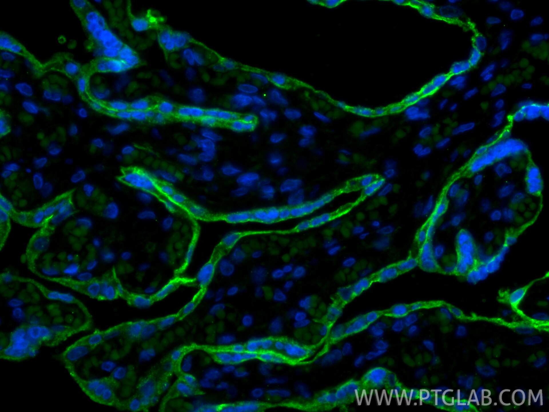Immunofluorescence (IF) / fluorescent staining of human placenta tissue using CoraLite® Plus 488-conjugated ALPPL2 Recombinant m (CL488-84813)