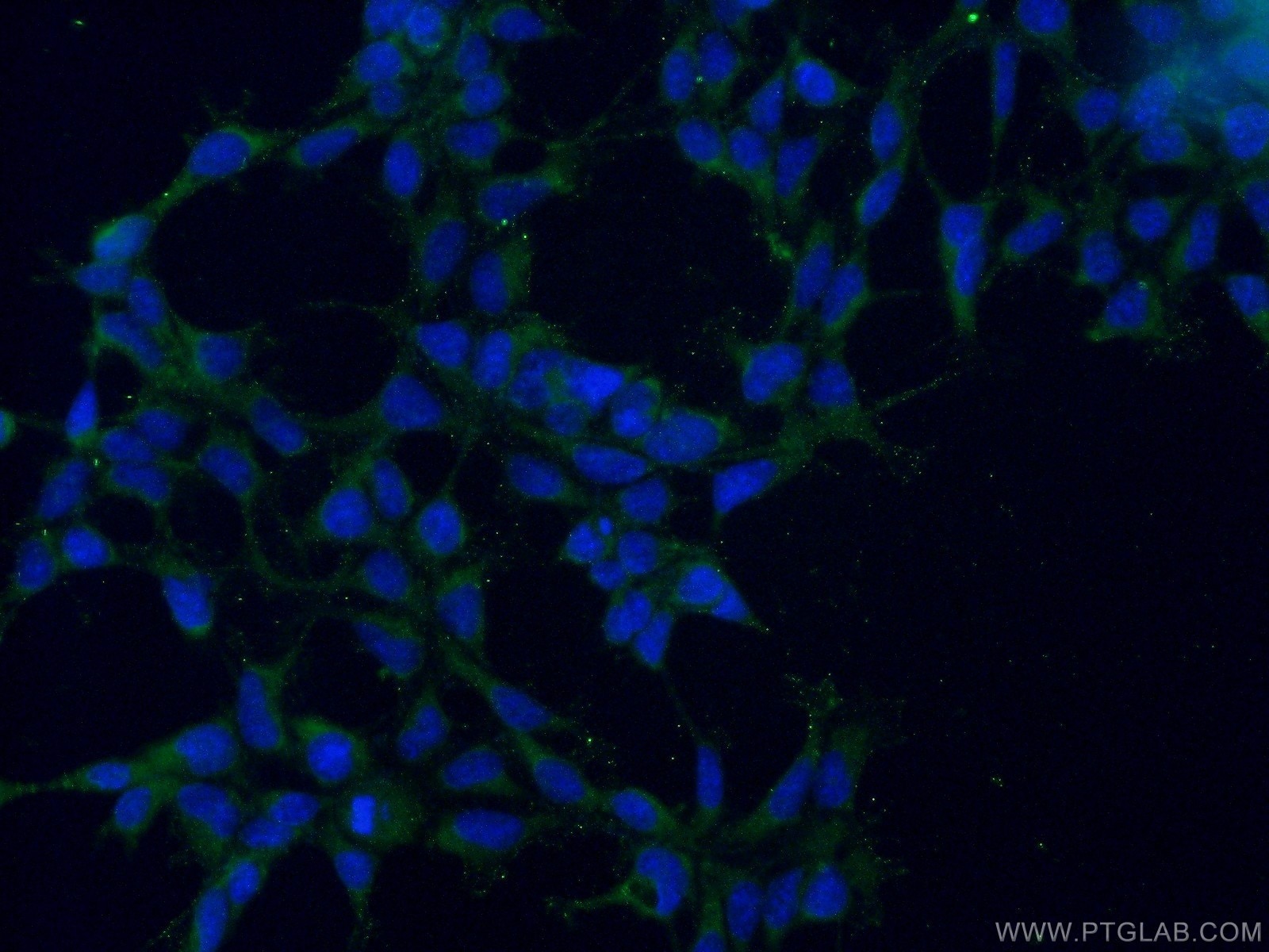 Immunofluorescence (IF) / fluorescent staining of HEK-293 cells using ALS2 Polyclonal antibody (13998-1-AP)