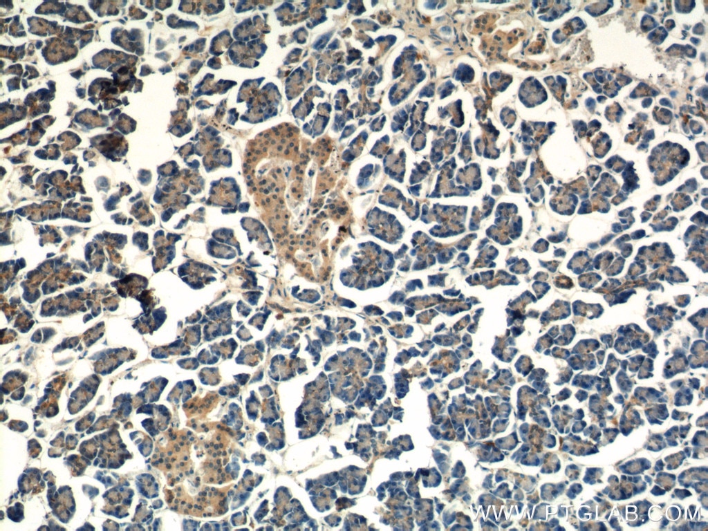 Immunohistochemistry (IHC) staining of human pancreas tissue using ALS2 Polyclonal antibody (13998-1-AP)