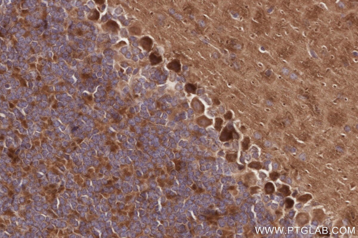 Immunohistochemistry (IHC) staining of mouse cerebellum tissue using ALS2 Polyclonal antibody (13998-1-AP)