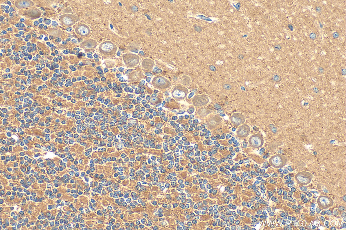 Immunohistochemistry (IHC) staining of mouse cerebellum tissue using ALS2 Polyclonal antibody (13998-1-AP)