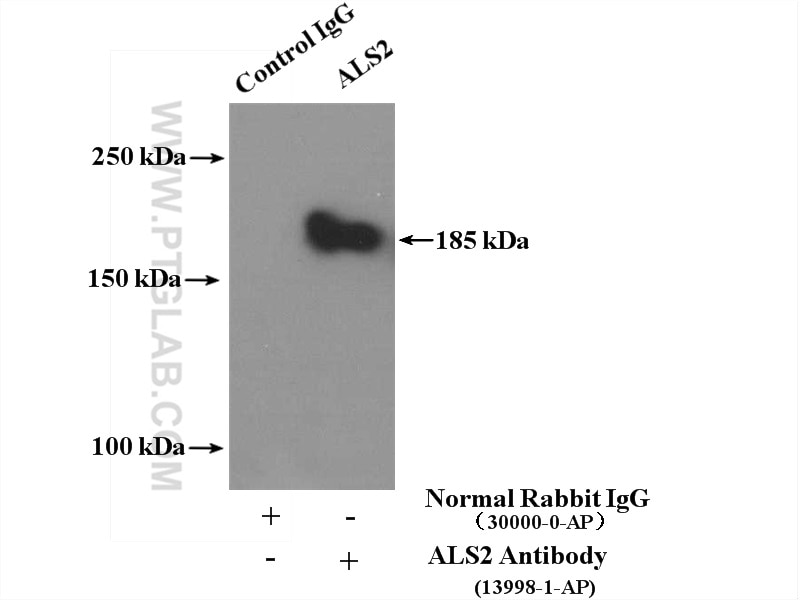 Immunoprecipitation (IP) experiment of HEK-293 cells using ALS2 Polyclonal antibody (13998-1-AP)