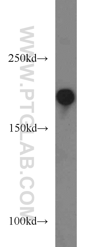 Western Blot (WB) analysis of HEK-293 cells using ALS2 Polyclonal antibody (13998-1-AP)